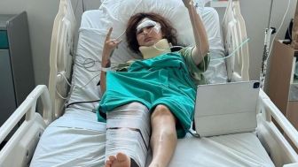 Kondisi Miris Angela Lee Setelah Kecelakaan : Implan Hidung Seperti Nyaris Jebol