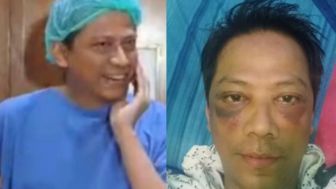 Doddy Sudrajat Akui Bercocok Tanam Dengan Puput Sebelum Menikah, Pacaran Tanpa Komitmen