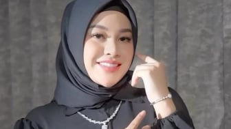 Wajahnya Makin Cantik, Aurel Hermansyah Dituding Operasi Plastik