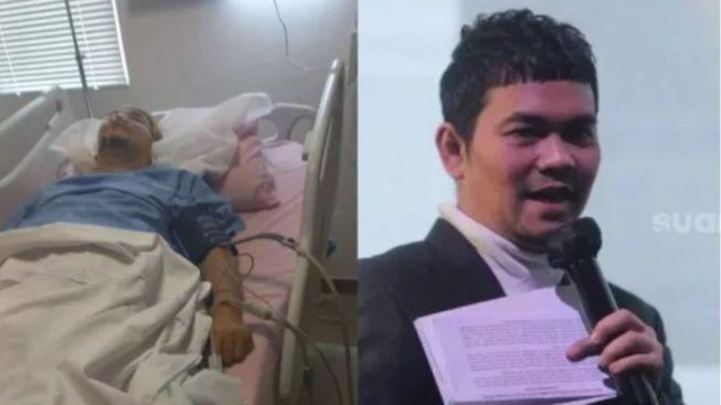3 Fakta Indra Bekti Alami Pendarahan Otak, Ditemukan Pingsan di Toilet hingga Kondisinya Kini Dipasangi Alat Medis