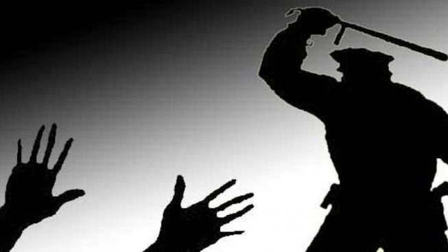 Geger Pengakuan Berani Eks Polwan Soal Banyak Polisi Tersandung Kasus: Mereka, Orang Terburuk di Dunia!