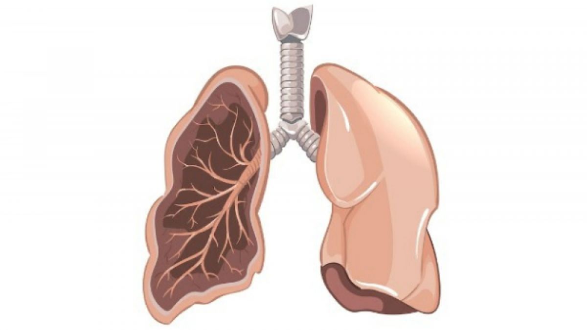 Ilustrasi. Gejala penyakit paru-paru [Freepik]