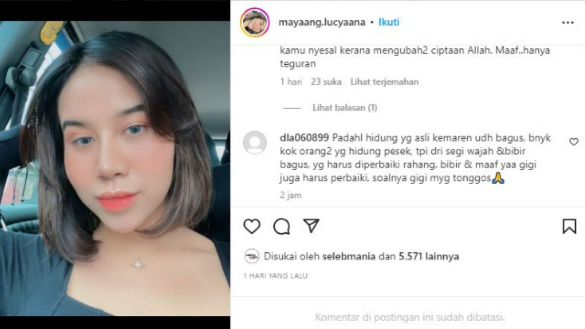 Hidung Mayang dianggap tidak terlalu banyak ada perubahan [(Instagram @mayaaang.lucyaana)]