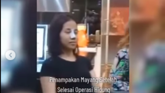 Mayang, Adik Vanessa Angle Viral Usai Operasi Plastik Hidung