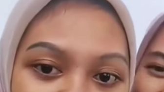 Cewek Ini Tidak Sadar Kalau Hidungnya Kemasukan Lintah, Netizen: Bisa-bisanya Ketawa