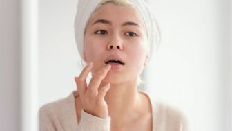 Bibir Pecah Saat Puasa? Simak Tips Disini