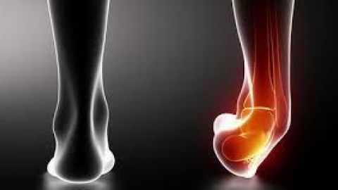Cedera Ankle, Ketahui Faktor Penyebab dan Cara Mengobatinya