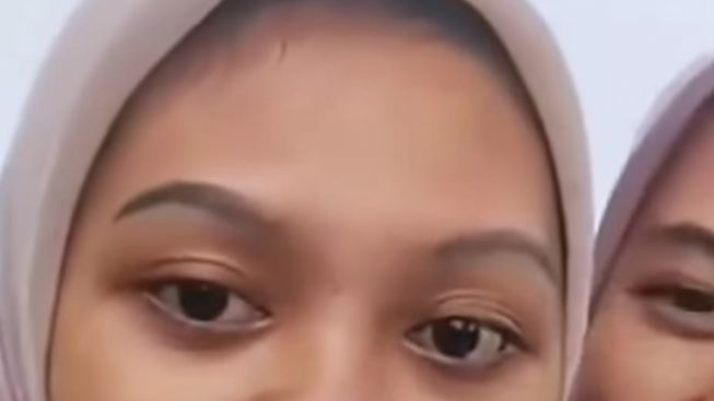 Cewek Ini Tidak Sadar Kalau Hidungnya Kemasukan Lintah, Netizen: Bisa-bisanya Ketawa