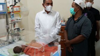 Gubsu Kunjungi Bayi Kembar Siam asal Asahan Ratih dan Ririn di RSUP HAM