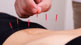Pada Usia Berapa Sudah Boleh Terapi Akupuntur?