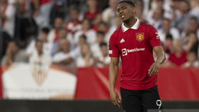 Anthony Martial Absen Bela Manchester United Hadapi Manchester City di Final Piala FA