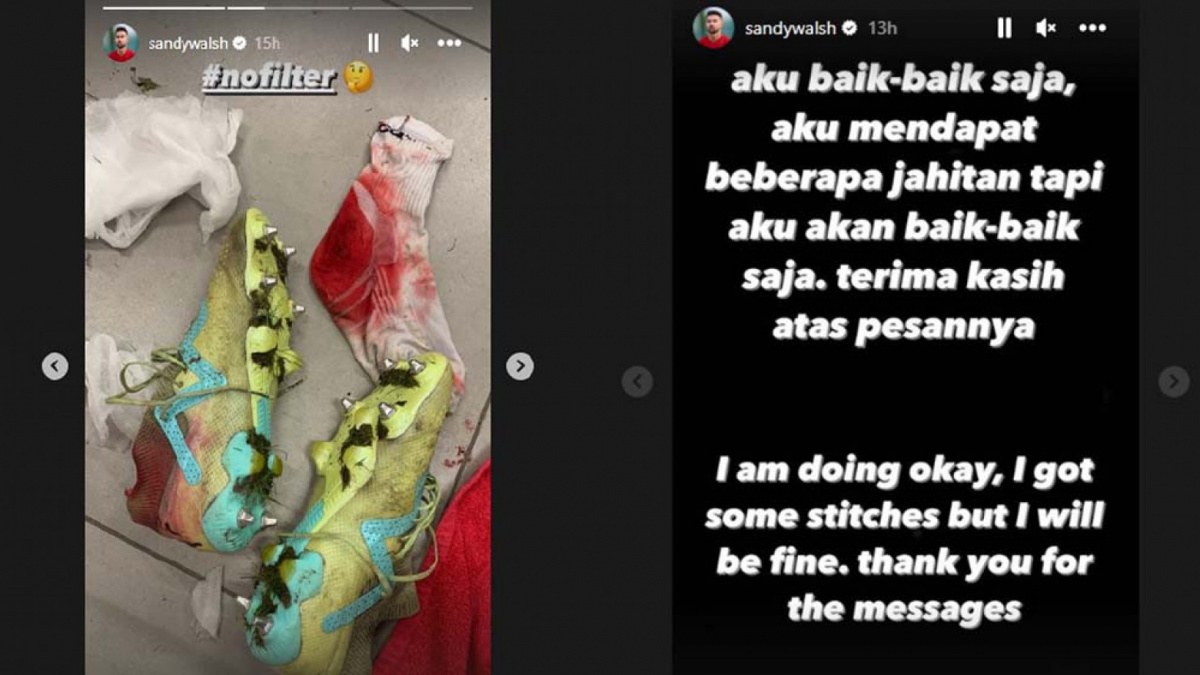 Unggahan instagram story Sandy Walsh pasca alami cedera horor saat memperkuat KV Mechelen