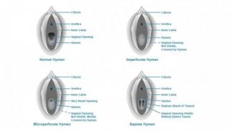Cara Tahu Orang Perawan atau Tidak Itu Ternyata Nggak Sulit, Cuma Lihat Ini Saja