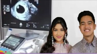 Cek Fakta Belum Lama Menikah, Erina Gudono Hamil Anak Kaesang?