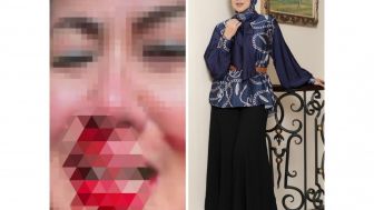 Heboh! Artis dan Model Senior, Venna Melinda Diduga Alami KDRT, Wajah Berlumuran Darah, Laporkan Suami ke Polda Jatim