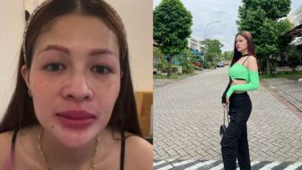 Seram! Wajah Tanpa Make Up Hesty Klepek-Klepek, Netizen: Tipis, Uratnya Kelihatan