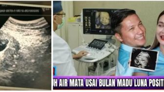 Positif Hamil! Dokter Ungkap Janin Luna Maya dan Gading Marten Setelah Menikah dan Bulan Madu, Benarkah?