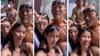 Netizen Salfok Sama Tanda Merah di Atas Dada Sabrina Istri Deddy Corbuzier, Benarkah Cupang?