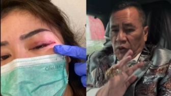 Keponakan Hotman Paris - Dessy Puspita Sari Jadi Korban KDRT, Polisi Gerak Cepat