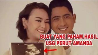 CEK FAKTA: Amanda Manopo Positif Hamil Anak Arya Saloka, Hasil USG Tampilkan Laki-laki, Benarkah?