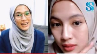 CEK FAKTA: Terkuak Penyakit Alyssa Soebandono, Dude Harlino Histeris, Netizen Mewek?