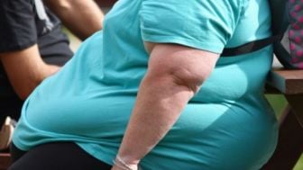 Waduh, Lebih dari 4 Miliar Orang di Dunia Bakal Mengalami Obesitas tahun 2035