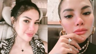 Nikita Mirzani Posting Foto Close-Up, Dikira Agnes Mo dan Nindy Ayunda Oleh Netizen