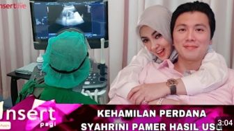 CEK FAKTA: Kehamilan Perdana Syahrini, Reino Barack Langsung Pamer Hasil USG