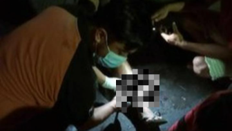 Kecelakaan Terjadi di Renon, Denpasar Selatan, Korban Alami Luka Robek pada Kaki Kiri