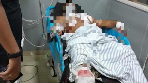 Begini Kronologi Malam Pengerupukan Berdarah di Jalan Veteran Denpasar Versi Polisi