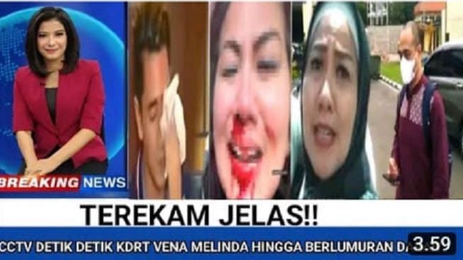 Beredar Video CCTV Detik-detik Venna Melinda Alami KDRT oleh Ferry Irawan di Hotel, Benarkah? Cek Faktanya!