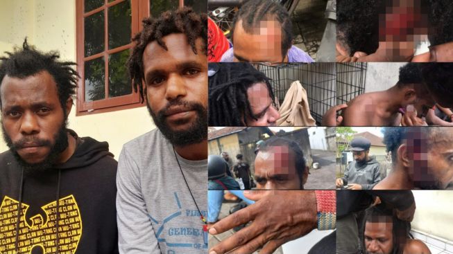 Aksi Damai Mahasiswa Papua Komite Kota Bali Dihadang, Puluhan Massa Aksi Terluka