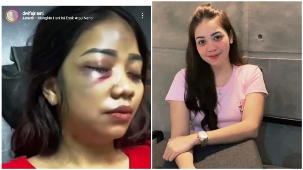 Video Viral Cewek Cantik Ini Dianiaya Sang Pacar Tkp Di Pekanbaru