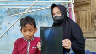 Viral! Bocah 9 Tahun Tidak Sengaja Telan Kunci Gembok