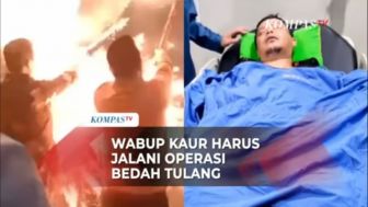 Wabup Kaur Harus Jalani Operasi Bedah Tulang karena Petasan Meledak di Tangan, Warganet: Contoh Nyata Buat Masyarakat!