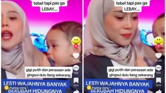 Lesti Kejora Disebut Nekat Modal Gede Buat Oplas, Warganet: Hidungnya Jelas Berubah