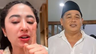 Dituding Tolak Sapi Kurban Dewi Perssik, Pak RT Langsung Beri Klarifikasi, Ternyata oh Ternyata, Begini Katanya...