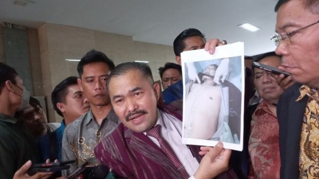 Pengacara Brigadir J Beberkan Fakta Uang Rp200 Juta yang Diduga Berpindah ke Rekening Ferdy Sambo Cs