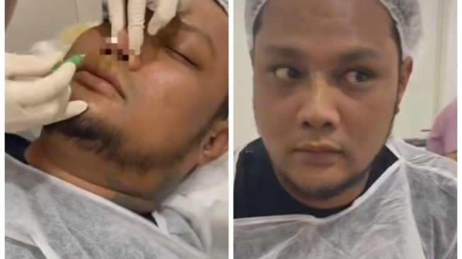 Virgoun Bayar Mahal Buat Perawatan Usai Kena Body Shaming, Warganet: Tetap Aja Nggak Ganteng