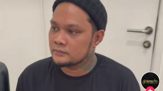 Getol Perawatan Wajah Sampai Disebut Mirip Inara Rusli, Virgoun: Agak Longsor ya Mukanya