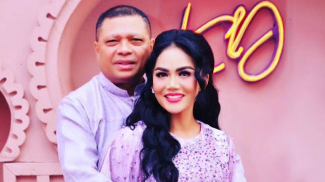 Krisdayanti Putuskan Lakukan Operasi Plastik, ini Tanggapan Raul Lemos : Saya sampai Sekarang Bingung...