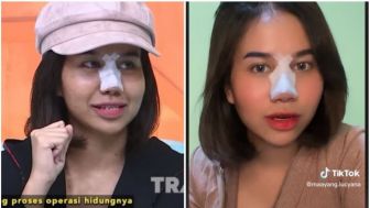 Mayang Dicap Tak Bersyukur Gegara Ngarep Rezeki Melimpah karena Hidung Baru: Emang Tuhan Kasih Rezeki dari Panjang Hidung?