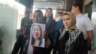 Venna Melinda Stres Gegara Ferry Irawan Minta Duit Pulsa hingga Bayar Cicilan Shoppe, Hotman Paris: Pusing Gak Lu Punya Suami Kayak Gitu