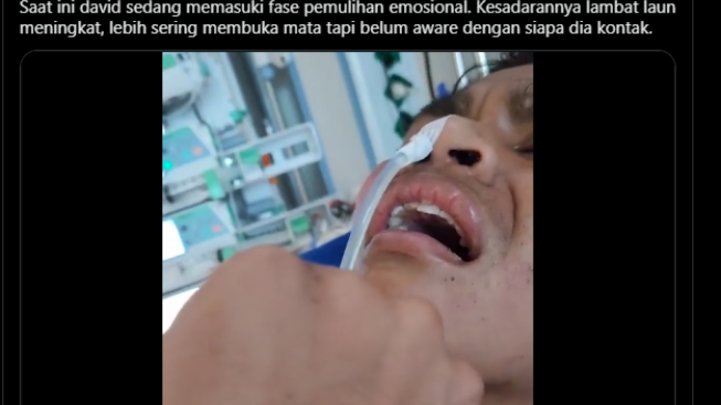 David Bangun dari Koma, Momen Jonathan Pegang Tangan Anaknya yang Mengepal: Aku Tahu Kamu Lagi Marah Tapi Sudah Cukup, Istighfar