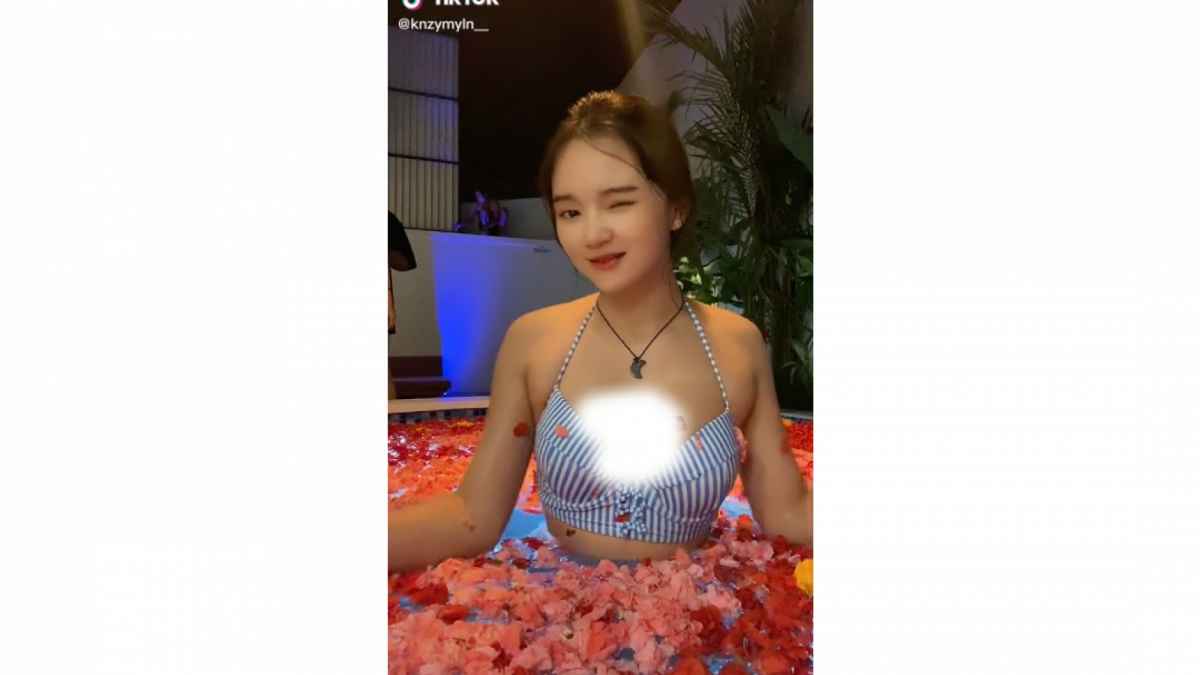 Kienzy Myelin atau Kienzy Mylien