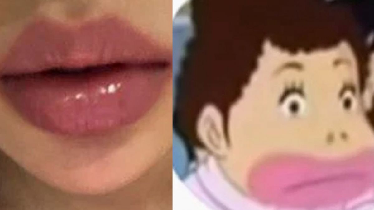 Profile picture Yves yang dipermasalahkan