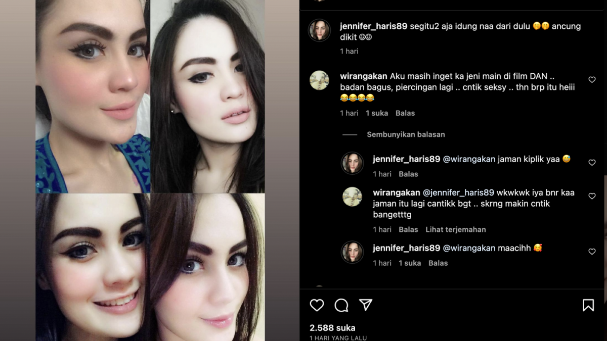 Jennifer Dunn yakinkan netizen hidungnya seperti itu dari dulu.