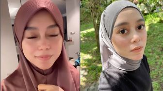 Lesti Kejora Tampil dengan Hidung Mancung dan Gigi Tak Maju, Oplas Muka atau Ulah Filter?