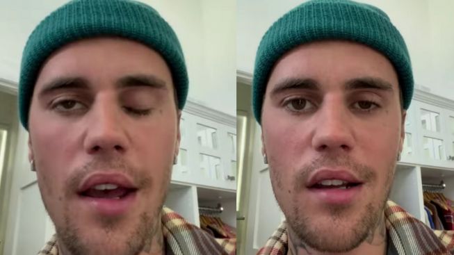 Alami Stroke di Wajah, Begini Kondisi Justin Bieber Saat Ini