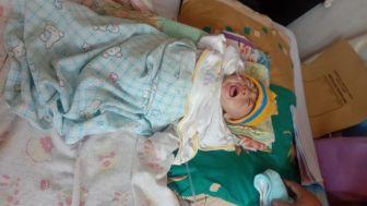 Bayi Gizi Buruk di Selaawi, Begini Kronologi dari Lahir Hingga Sekarang Dirawat Intensif di RSUD dr Slamet Garut